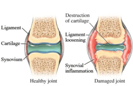 Everything you should know about dog arthritis 1 Everything you should know about dog arthritis